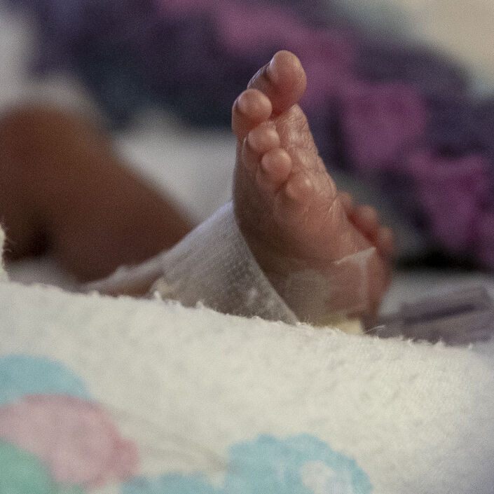 Close up of baby's foot attached to medical tubes