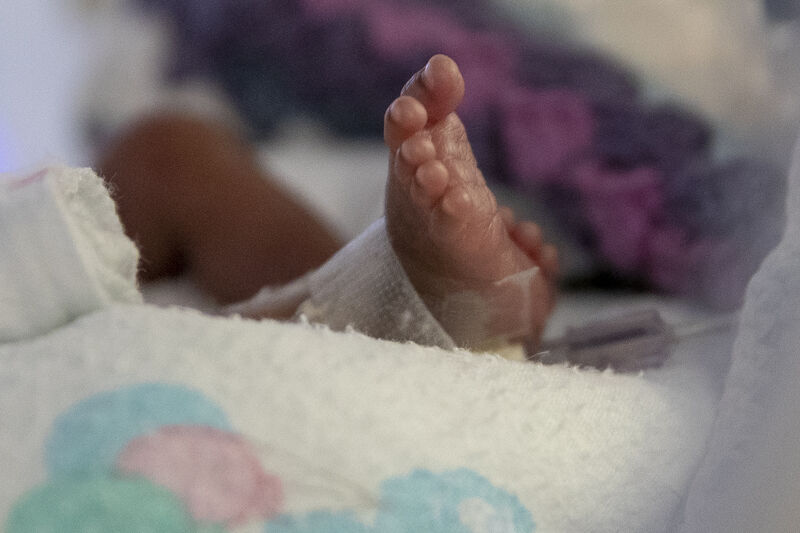 Close up of baby's foot attached to medical tubes