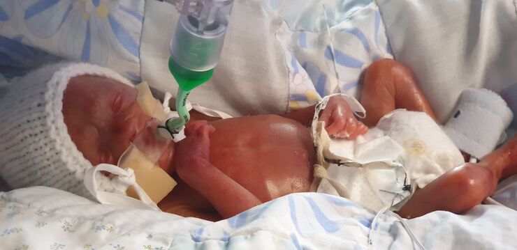 Ethan's baby Oliver on the unit