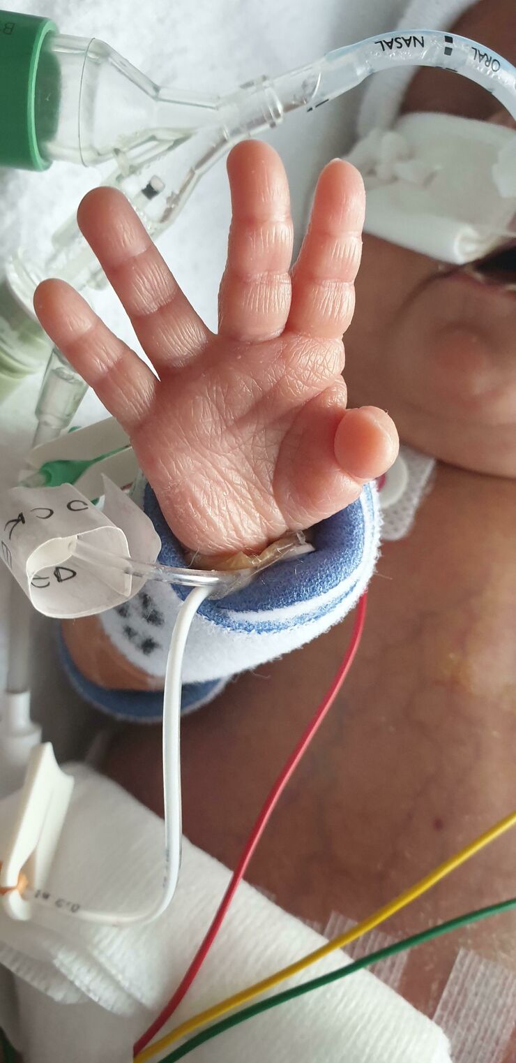 Ethan's baby's hand