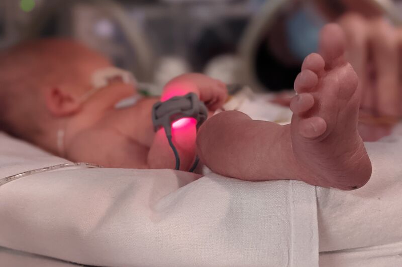 Dolly's baby in the incubator