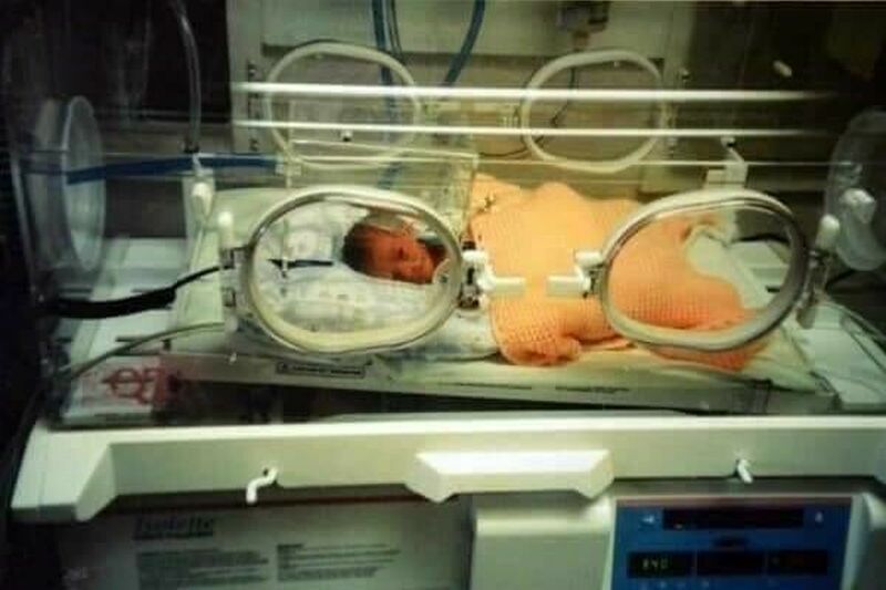 Jasmine in the incubator in 1997