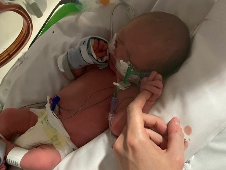 Baby in hospital attached to tubes holding parent's finger