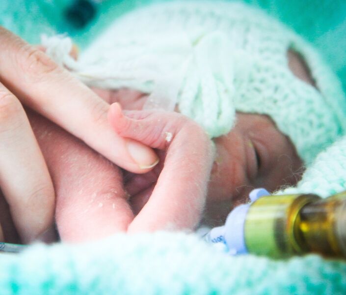 Premature baby attached to a tube with their mother's hand on them