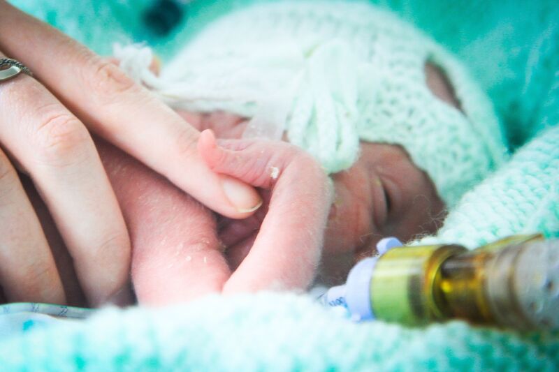 Premature baby attached to a tube with their mother's hand on them