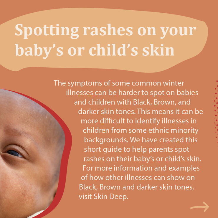 Information about the symptom spotting guide.