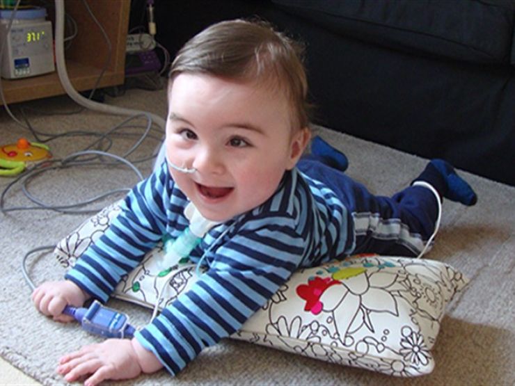 Baby boy lying on his front on a pillow, attached to medical equipment looking up and smiling at camera