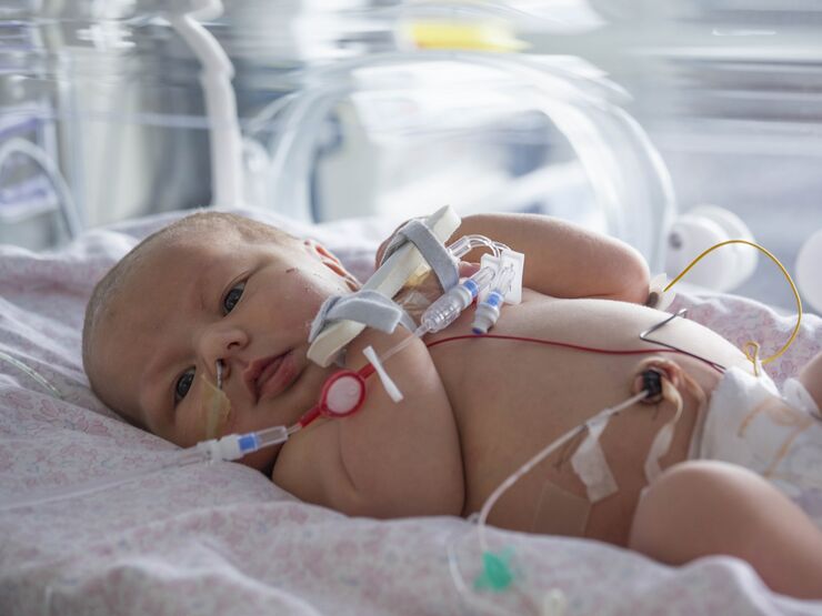 Cute baby lying on its back on a hospital bed attached to tubes while looking at the camera
