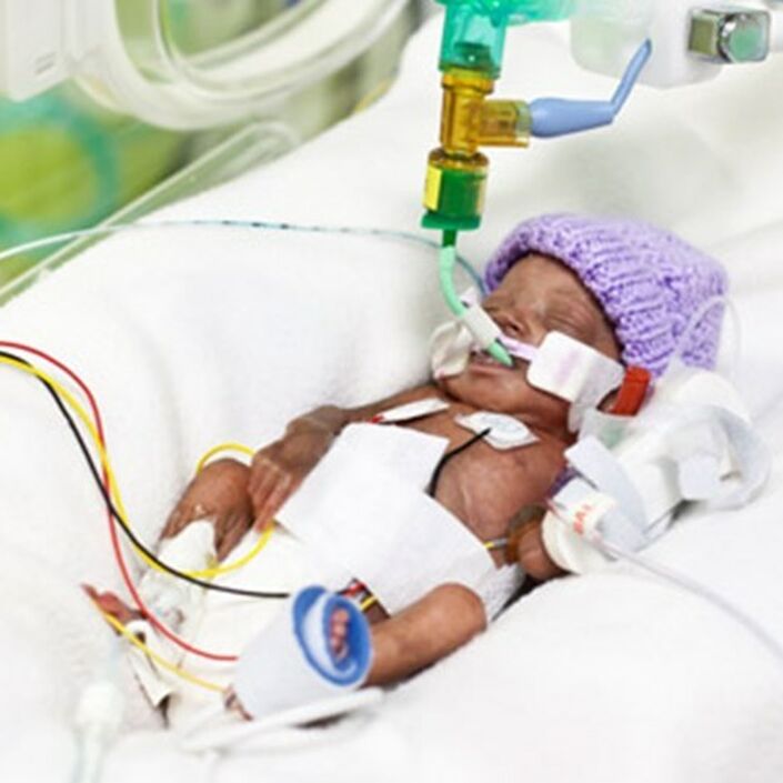 Premature baby in a hospital bed wearing a purple wool hat attached to several tubes