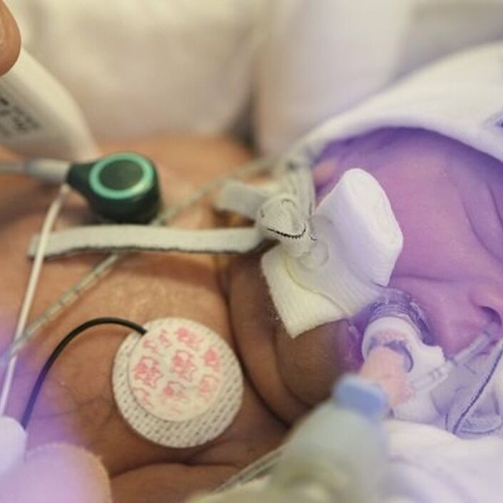 Baby receiving care in hospital through various tubes and machines