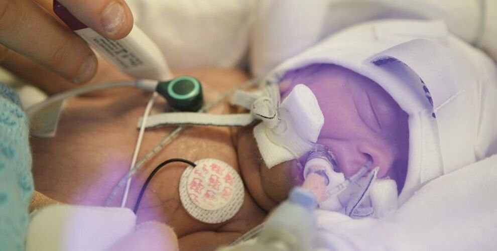 Baby receiving care in hospital through various tubes and machines