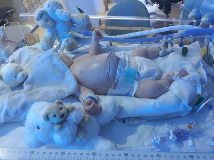 Baby Kane receives specialist care for NEC