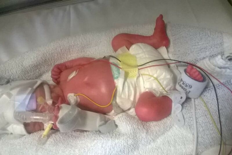 Alexandra's Story Hero