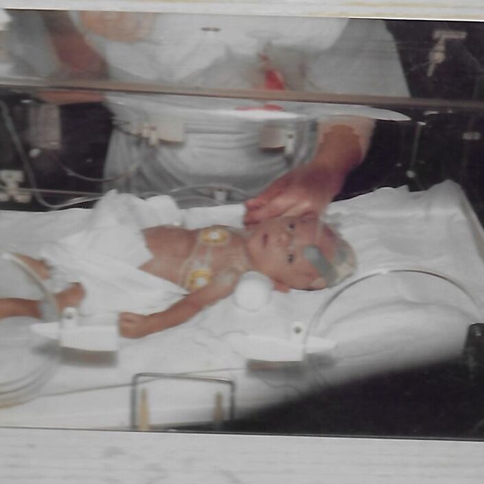 Geoff's Story   What It Was Like To Be Born Premature Hero