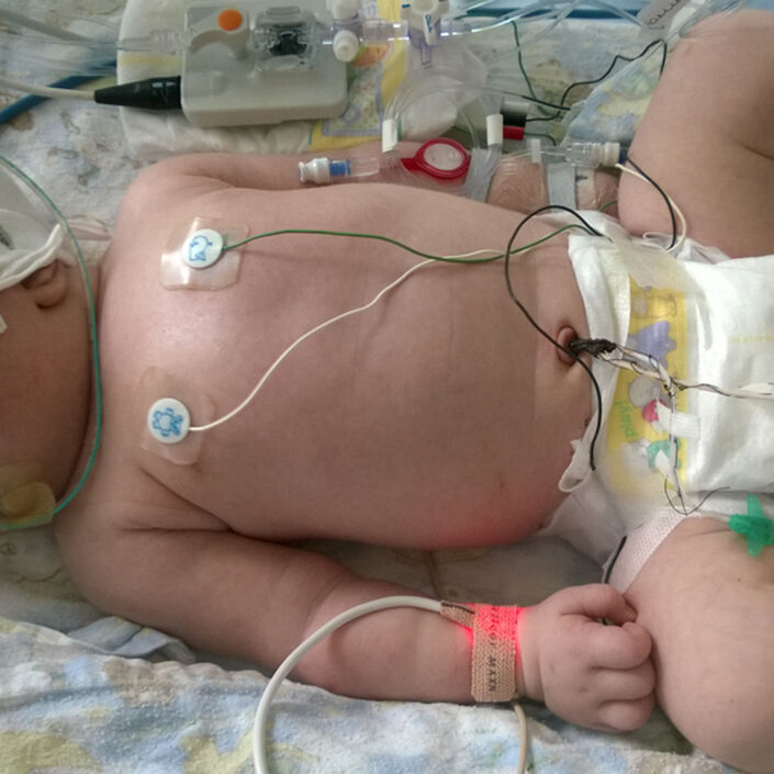 Katherine's Story Hero