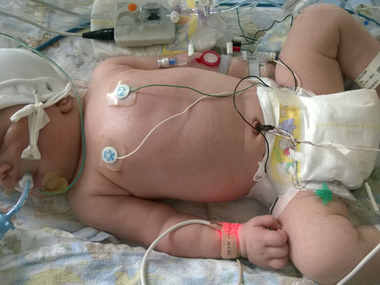 Katherine's Story Hero