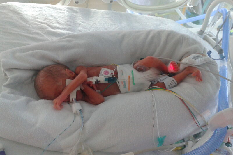 Lauren And Alexa's Story Hero