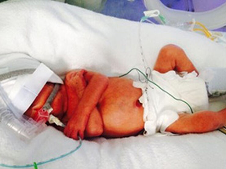 Georgina's Story Hero