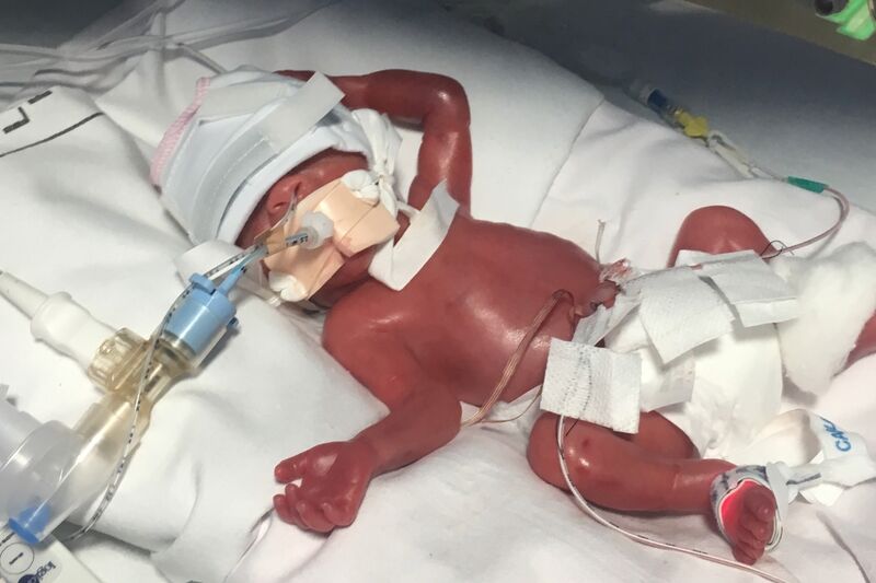 Stephanie's Story Hero