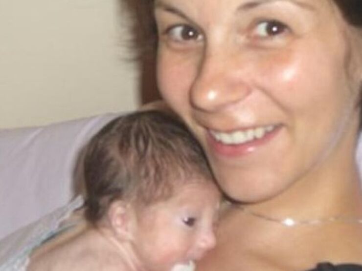 Leigh's Experience Of The 'life Saving' Power Of Skin To Skin Contact Hero