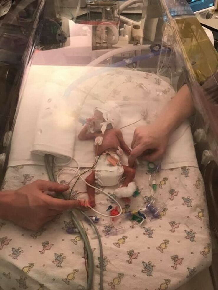 Rex in an incubator, being gently touched by his mum and his dad