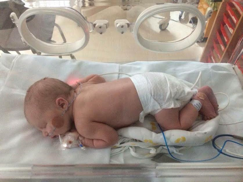 NICU Milestones: The First Diaper Change was the Hug I'd Been