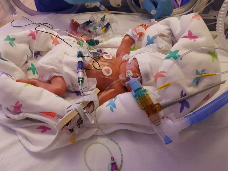 Anya NICU couple of days old