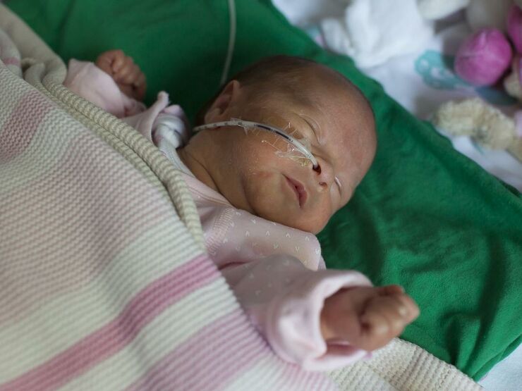 Baby asleep on its back being tube fed through its nose