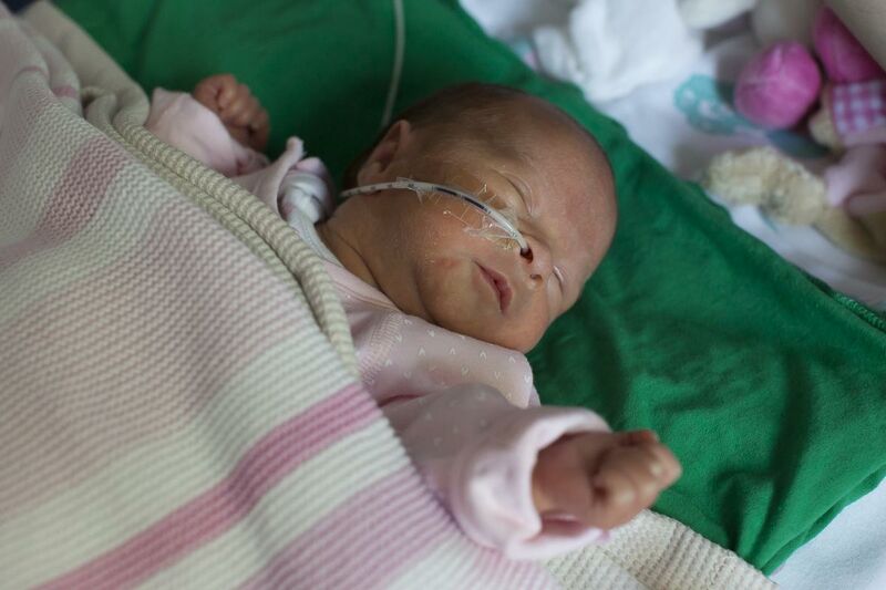 Baby asleep on its back being tube fed through its nose
