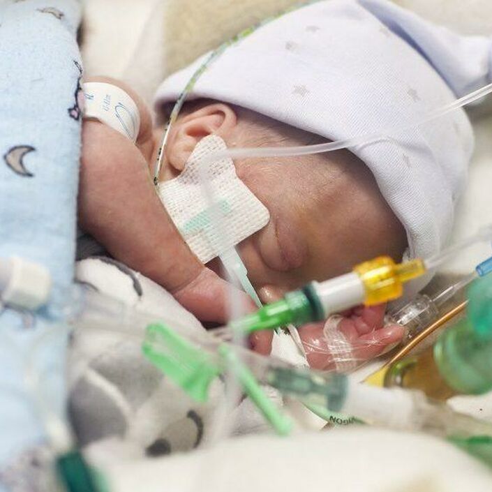 Premature baby wearing a wooly hat sleeping peacefully attached to several tubes