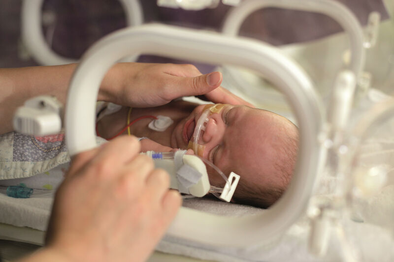 Mum caressing premature baby in an incubator. Baby attached to various tubes