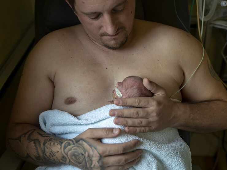 Dad doing skin-to-skin care with baby with a tube