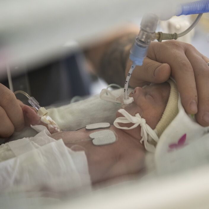 Premature baby attached to tubes being comforted by parent's hands