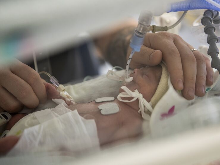 Premature baby attached to tubes being comforted by parent's hands