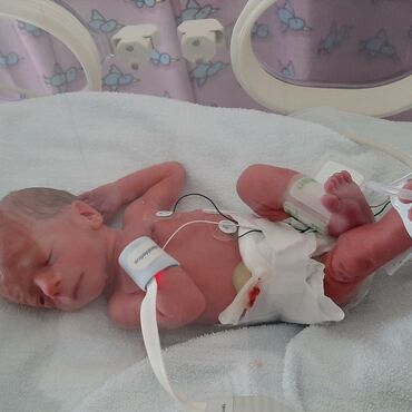 Miles in the incubator