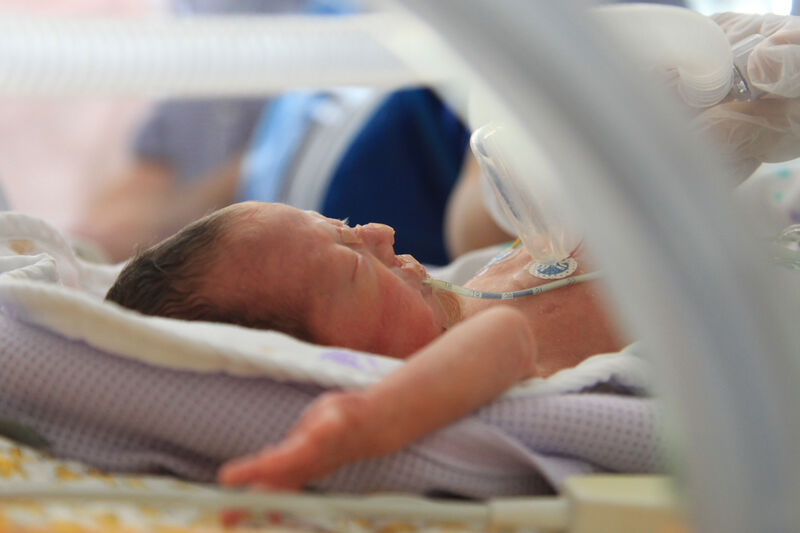 Baby in an incubator attached to tube sleeping