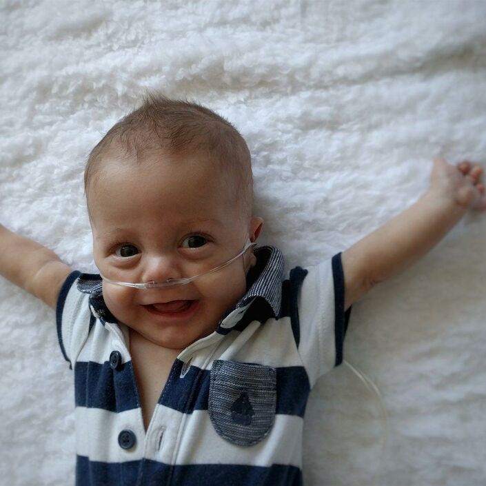 Baby attached to feeding tube lying down with arms outstretched and smiling