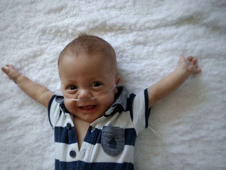 Baby attached to feeding tube lying down with arms outstretched and smiling