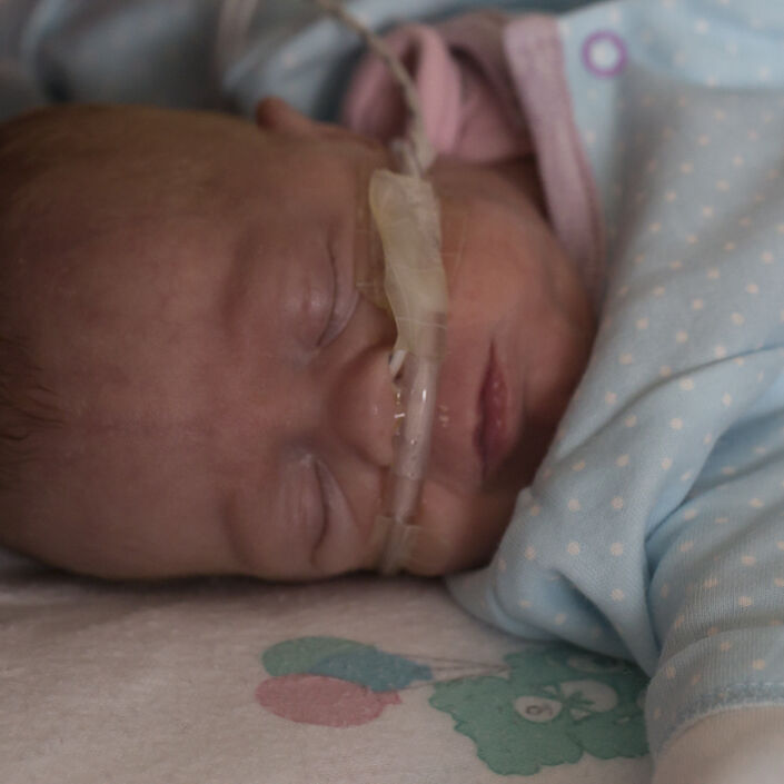 Baby in pyjamas sleeping peacefully with a tube attached to their nose