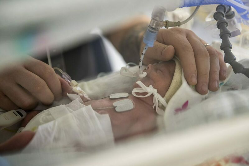 A baby lying in an incubator, receiving oxygen through a tube. One of its parent's hands is resting on its head, the other is holding its hand.