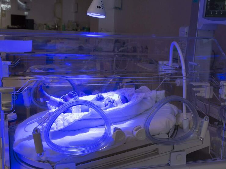 Baby in an incubator undergoing blue light phototherapy