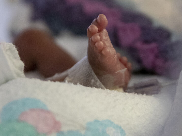 Close up of baby's foot attached to medical tubes