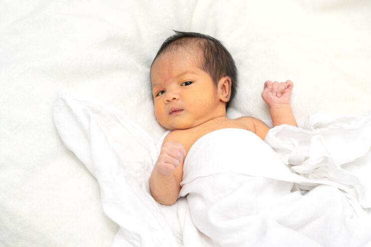 Baby lying under a blanket, with yellowing skin to their face and upper chest