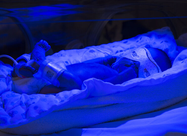Premature baby receiving phototherapy (blue light source) in an incubator