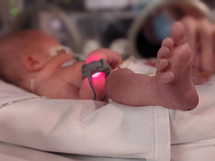 Dolly's baby in the incubator