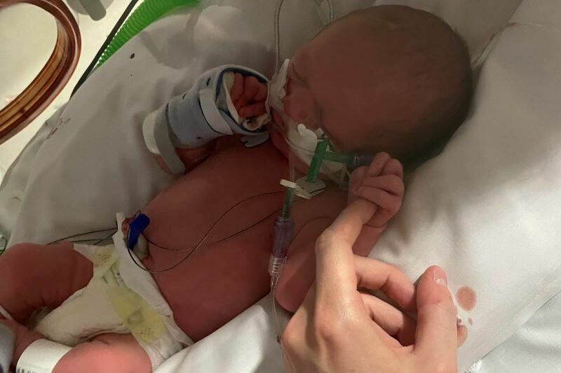 Baby in hospital attached to tubes holding parent's finger