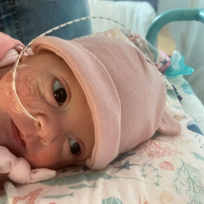 Aoife intubated
