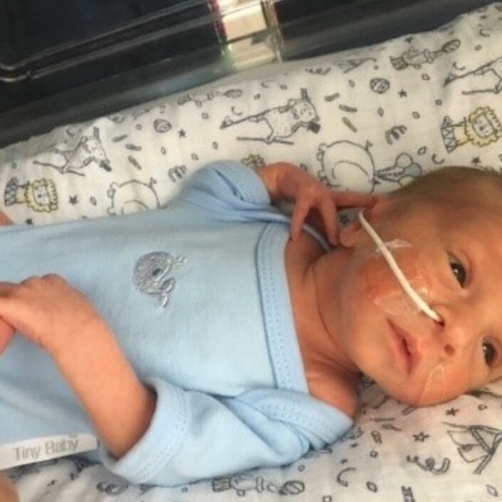 Toms baby with feeding tube