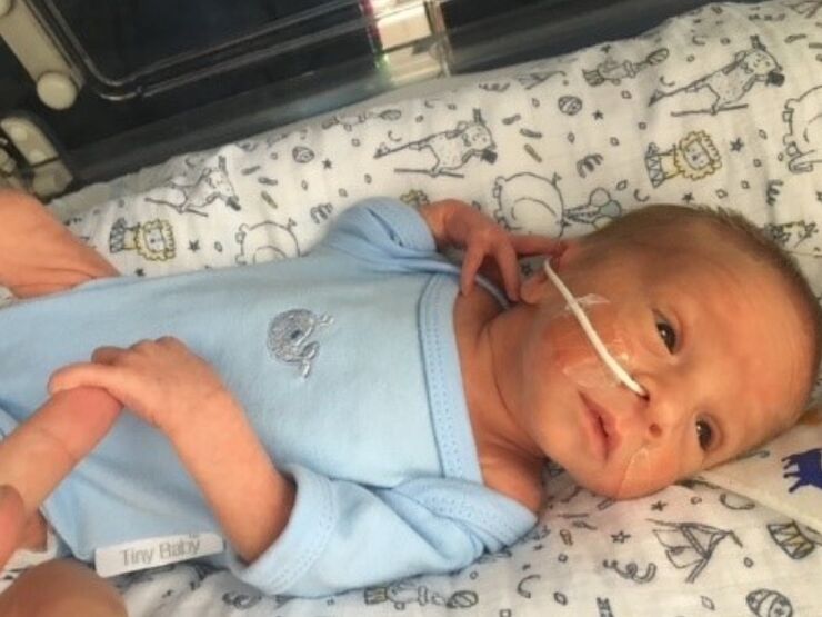 Toms baby with feeding tube