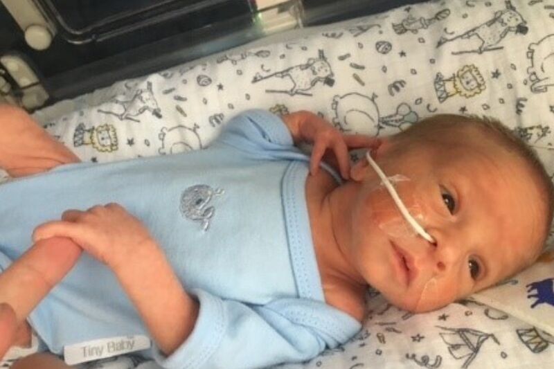 Toms baby with feeding tube